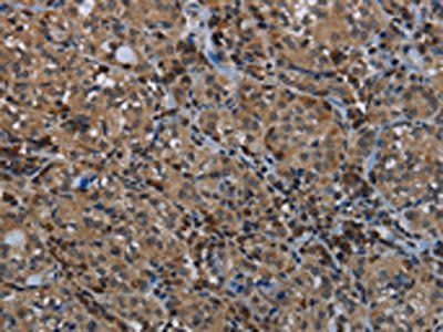 GYS1 Antibody