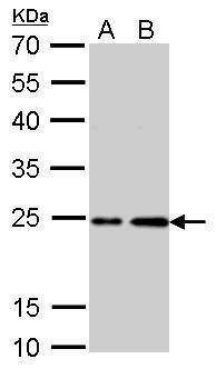 H-Ras antibody