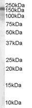 Hamartin/TSC1 (isoform 1) Antibody