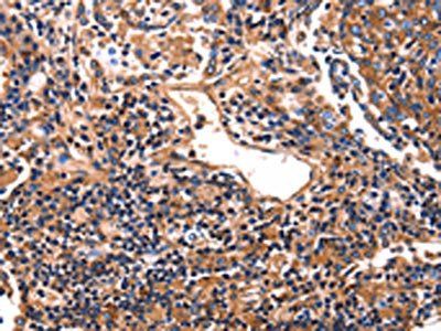 HP Antibody