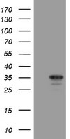 HARS2 Antibody
