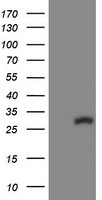 HARS2 Antibody