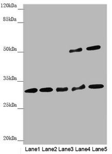 HCCS Antibody