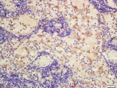 Cytomegalovirus Glycoprotein B Rabbit Polyclonal Antibody