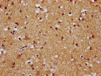 HCN1 Antibody