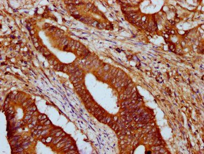 HCN1 Antibody