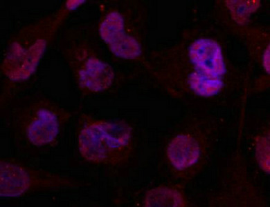 HDAC4 Antibody