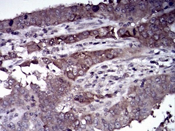 HDAC4 Antibody