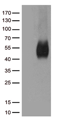 HDAC8 Antibody
