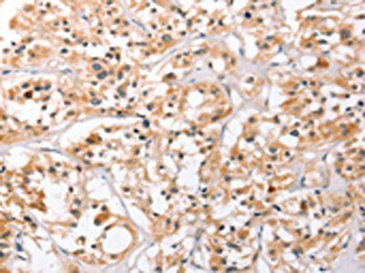 HDAC8 Antibody