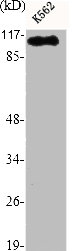HDAC9 Antibody