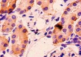 HAVCR2 Antibody
