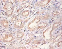 ERBB2 Antibody