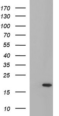 ERBB2 Antibody