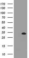 ERBB2 Antibody