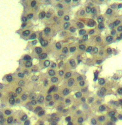 Her3/ErbB3 Rabbit Polyclonal Antibody