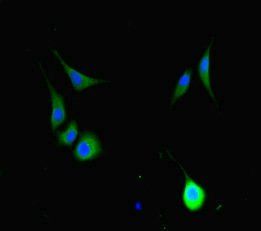 HFM1 Antibody
