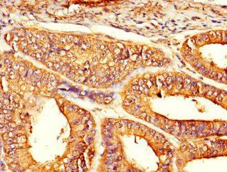 HFM1 Antibody