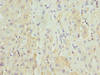 HGD Antibody