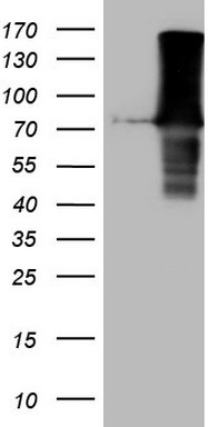 hHR23b Antibody