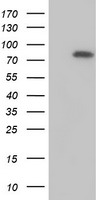HIBCH Antibody