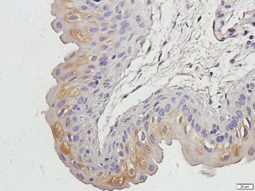 HIF-1alpha Rabbit Polyclonal Antibody