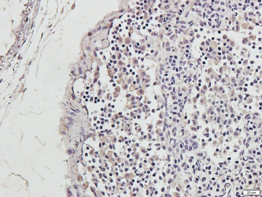 HIF-1alpha Rabbit Polyclonal Antibody