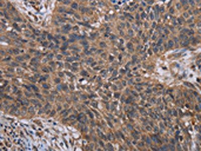 HIF1A Antibody