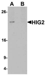 HIG2 Rabbit Polyclonal Antibody
