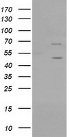 IFT57 Antibody