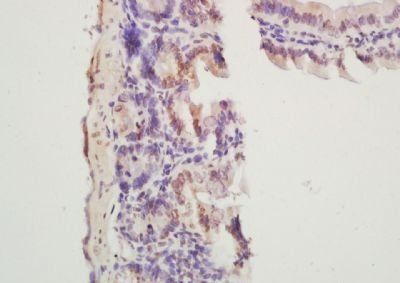 Bivalirudin Rabbit Polyclonal Antibody