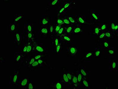 HIST1H1C Antibody
