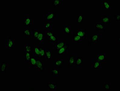 Phospho-HIST1H1D (T179) Antibody