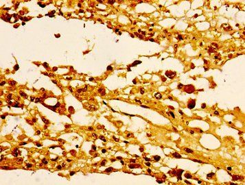 HIST1H1E Antibody