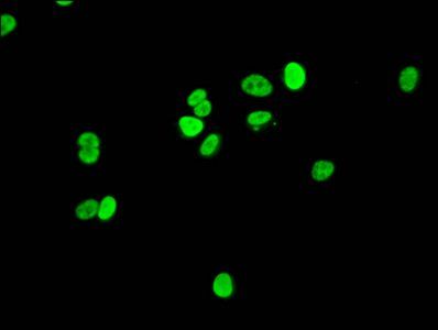 HIST1H1E Antibody