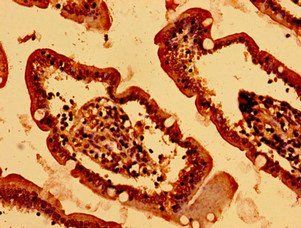 HIST1H2BK Antibody
