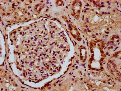 HIST1H3A (Ab-11) Antibody