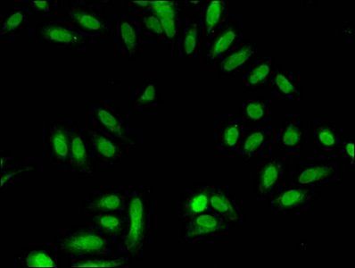 HIST1H3A (Ab-18) Antibody