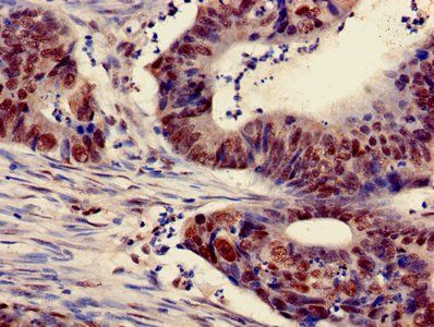HIST1H3A (Ab-18) Antibody
