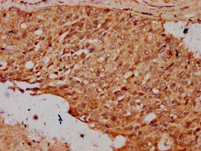 HIST1H3A (Ab-23) Antibody