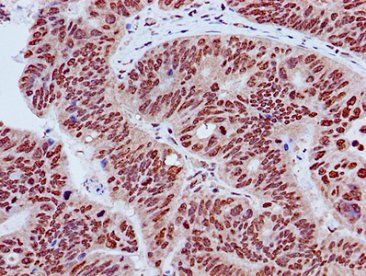 HIST1H3A (Ab-27) Antibody