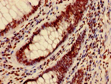HIST1H3A (Ab-4) Antibody