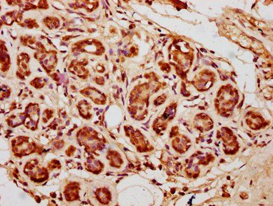 HIST1H3A (Ab-4) Antibody