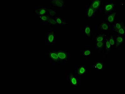 HIST1H3A (Ab-9) Antibody