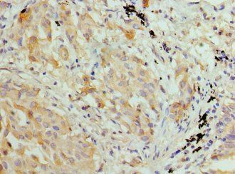 HIST2H3A Antibody