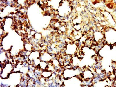 HIVEP3 Rabbit Polyclonal Antibody