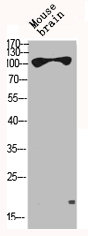 HK1 Antibody