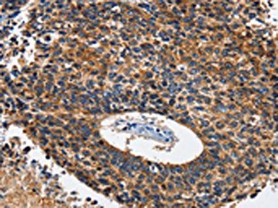 HK2 Antibody