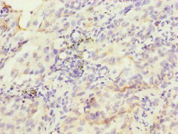 HK3 Antibody