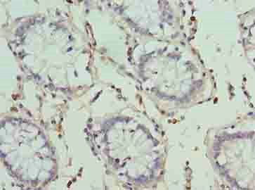 HKDC1 Antibody